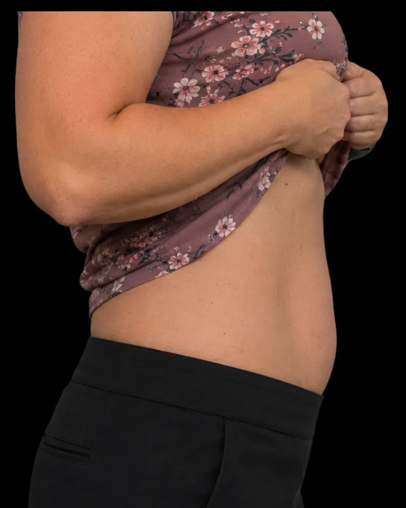 After the BAQ Method, abdomen